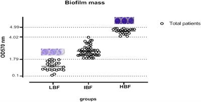 Transcription Factors of CAT1, EFG1, and BCR1 Are Effective in Persister Cells of Candida albicans-Associated HIV-Positive and Chemotherapy Patients